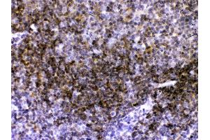 CD40/TNFRSF5 was detected in paraffin-embedded sections of mouse lymphaden tissues using rabbit anti- CD40/TNFRSF5 Antigen Affinity purified polyclonal antibody (Catalog # ) at 1 ? (CD40 antibody  (AA 20-193))