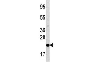 Western blot analysis of Bad antibody and HL-60 lysate. (BAD antibody  (AA 53-81))