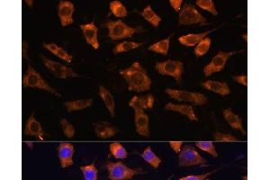 Immunofluorescence analysis of L929 cells using CYR61 Polyclonal Antibody at dilution of 1:100. (CYR61 antibody)