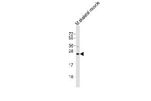 All lanes : Anti-Ctf1 Antibody at 1:2000 dilution + mouse skeletal muscle lysates Lysates/proteins at 20 μg per lane. (Cardiotrophin 1 antibody)