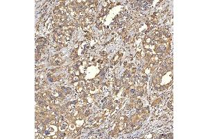 IHC analysis of TST using anti-TST antibody (ABIN7599105).