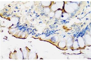 Immunohistochemistry of paraffin-embedded Human colon using CRTAP Polyclonal Antibody at dilution of 1:100 (40x lens).