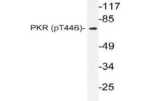 Western blot (WB) analyzes of p-PKR (pThr446) antibody in extracts from NIH-3T3 IFN cells. (EIF2AK2 antibody  (pThr446))