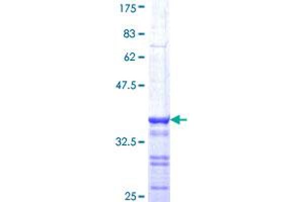 BRCA1 Protein (AA 1581-1670) (GST tag)