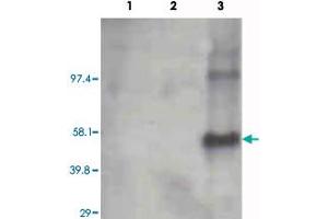 Western blot using Cyp1a2 monoclonal antibody, clone, 3B8C1  on recombinant CYP1B1 (lane 1), CYP1A1 (lane 2) and Cyp1a2 (lane 3) (0. (CYP1A2 antibody)