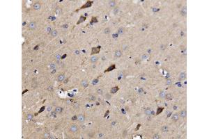 anti-ATG9 Autophagy Related 9 Homolog A (S. Cerevisiae) (ATG9A) (AA 22-169) antibody