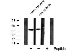 Western blot analysis of I kappaB alpha phosphorylation expression in mouse muscle and mouse brain lysates,The lane on the right is treated with the antigen-specific peptide.