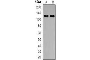 Western blot analysis of NBC1 expression in PC3 (A), A549 (B) whole cell lysates. (SLC4A4 antibody)