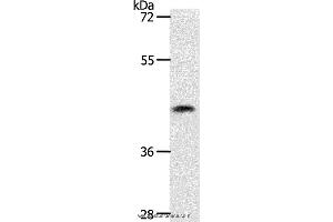 Western blot analysis of 231 cell, using PLAT Polyclonal Antibody at dilution of 1:450 (PLAT antibody)
