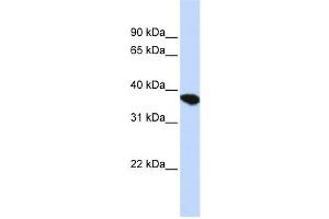 Western Blotting (WB) image for anti-ST8 alpha-N-Acetyl-Neuraminide alpha-2,8-Sialyltransferase 4 (ST8SIA4) antibody (ABIN2459219) (ST8SIA4 antibody)
