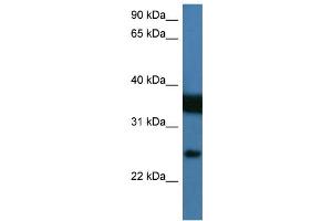 WB Suggested Anti-ZMAT2 Antibody Titration:  0. (ZMAT2 antibody  (N-Term))