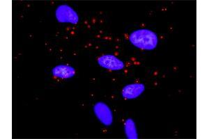 Proximity Ligation Analysis of protein-protein interactions between AKT1 and MTOR. (MTOR antibody  (AA 1521-1620))