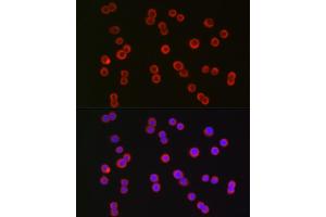 Immunofluorescence analysis of HT-29 cells using CFTR Rabbit pAb (ABIN6129855, ABIN6138469, ABIN6138470 and ABIN6224429) at dilution of 1:150 (40x lens). (CFTR antibody  (AA 1161-1480))