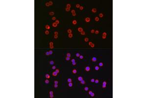 Immunofluorescence analysis of HT-29 cells using CFTR Rabbit pAb (ABIN6129855, ABIN6138469, ABIN6138470 and ABIN6224429) at dilution of 1:150 (40x lens). (CFTR antibody  (AA 1161-1480))