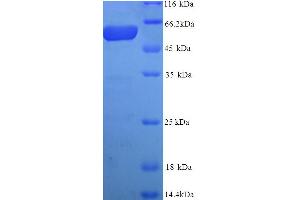 SDS-PAGE (SDS) image for Premelanosome Protein (PMEL) (AA 25-467) protein (His tag) (ABIN5713832) (Melanoma gp100 Protein (AA 25-467) (His tag))