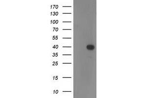 Western Blotting (WB) image for anti-Reticulon 4 Interacting Protein 1 (RTN4IP1) antibody (ABIN1500772)