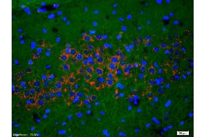 Formalin-fixed and paraffin-embedded rat brain labeled with Anti-Phospho-NMDAR1(Ser890) Polyclonal Antibody, Unconjugated (ABIN744278) 1:200, overnight at 4°C, The secondary antibody was Goat Anti-Rabbit IgG, Cy3 conjugated used at 1:200 dilution for 40 minutes at 37°C. (GRIN1/NMDAR1 antibody  (pSer890))