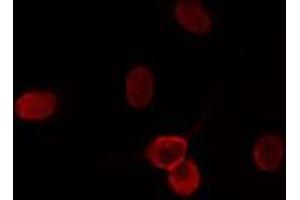 ABIN6274197 staining HuvEc cells by IF/ICC. (CDK11 antibody  (N-Term))