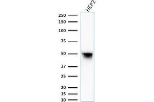 Western Blot Analysis of HEP2 cell lysate using Vimentin Mouse Monoclonal Antibody (VM1170).