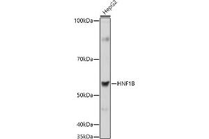 Western blot analysis of extracts of HepG2 cells, using HNF1B antibody (ABIN3017358, ABIN3017359, ABIN3017360, ABIN1680315 and ABIN1680316) at 1:1000 dilution.