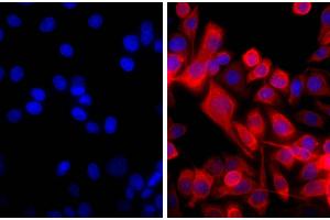 Human pancreatic carcinoma cell line MIA PaCa-2 was stained with Mouse Anti-Cytokeratin 18-UNLB and DAPI. (Goat anti-Mouse IgG (Heavy & Light Chain) Antibody - Preadsorbed)