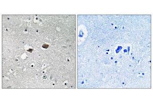 Immunohistochemistry (IHC) image for anti-Tigger Transposable Element Derived 3 (TIGD3) (C-Term) antibody (ABIN1852280) (TIGD3 antibody  (C-Term))