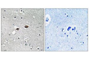 Immunohistochemistry (IHC) image for anti-Tigger Transposable Element Derived 3 (TIGD3) (C-Term) antibody (ABIN1852280) (TIGD3 antibody  (C-Term))