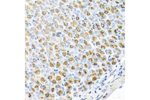 Immunohistochemistry of paraffin-embedded mouse stomach using FECH antibody at dilution of 1:100 (x40 lens). (FECH antibody)