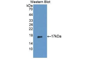 Figure. (PIP antibody  (AA 41-139))