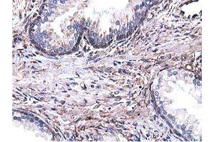 Immunohistochemical staining of paraffin-embedded Human Kidney tissue using anti-CYB5R3 mouse monoclonal antibody. (CYB5R3 antibody)