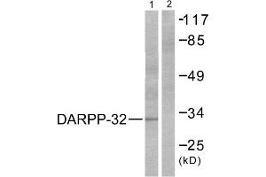 Western Blotting (WB) image for anti-Protein Phosphatase 1, Regulatory (Inhibitor) Subunit 1B (PPP1R1B) (Thr75) antibody (ABIN1847886)