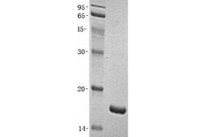 Validation with Western Blot (FABP2 Protein)