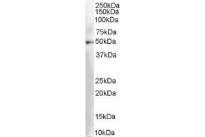 Western Blotting (WB) image for anti-Dopa Decarboxylase (Aromatic L-Amino Acid Decarboxylase) (DDC) (AA 464-475) antibody (ABIN295679) (DDC antibody  (AA 464-475))