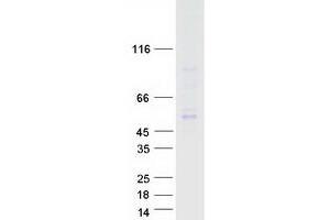 Validation with Western Blot