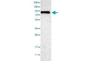Western blot analysis of Human cell line RT-4 with SH3BP1 polyclonal antibody  at 1:100-1:250 dilution.