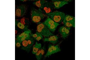 Immunofluorescence Analysis of T98G cells labeling Pgp9. (UCHL1 antibody)