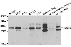 Western blot analysis of extracts of various cell lines, using PDGFB antibody. (PDGFB antibody)