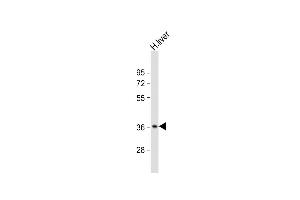 Anti-CTBS Antibody (N-Term) at 1:2000 dilution + human liver lysate Lysates/proteins at 20 μg per lane. (CTBS antibody  (AA 85-119))