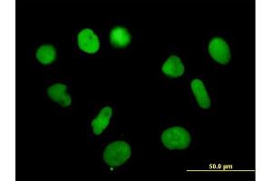 Immunofluorescence of purified MaxPab antibody to RPA3 on HeLa cell. (RPA3 antibody  (AA 1-121))