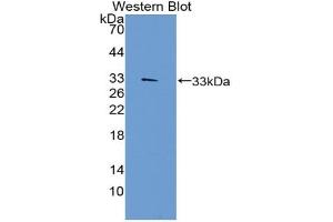 Detection of Recombinant TEP1, Human using Polyclonal Antibody to Telomerase protein component 1 (TEP1) (TEP1 antibody  (AA 2368-2627))