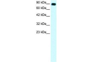 Human Daudi; WB Suggested Anti-C13ORF8 Antibody Titration: 1. (ZNF828 antibody  (Middle Region))