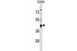 Western Blotting (WB) image for anti-Potassium Voltage-Gated Channel, Subfamily G, Member 2 (Kcng2) antibody (ABIN3000617)