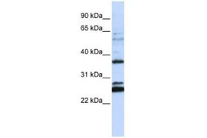 FAM70A antibody used at 1 ug/ml to detect target protein. (FAM70A antibody  (N-Term))