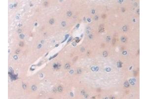 Immunohistochemistry (IHC) image for anti-Pyridoxal Kinase (PDXK) (AA 35-251) antibody (ABIN7440311)