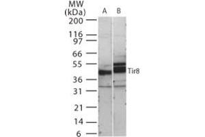 Image no. 1 for anti-Single Immunoglobulin and Toll-Interleukin 1 Receptor (TIR) Domain (SIGIRR) (AA 334-358) antibody (ABIN208840) (SIGIRR antibody  (AA 334-358))