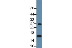 Detection of AQP2 in Human 293T cell lysate using Polyclonal Antibody to Aquaporin 2, Collecting Duct (AQP2) (AQP2 antibody  (AA 177-271))