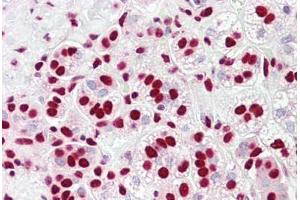 Anti-HnRNP K antibody IHC staining of human adrenal. (HNRNPK antibody  (AA 200-250))