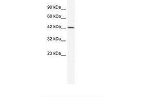 Image no. 1 for anti-T-Box 6 (TBX6) (AA 62-111) antibody (ABIN6735981) (T-Box 6 antibody  (AA 62-111))