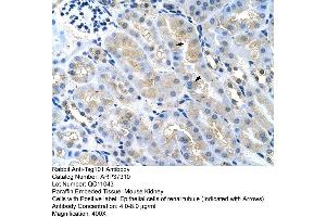 Rabbit Anti-Tsg101 Antibody  Paraffin Embedded Tissue: Mouse Kidney Cellular Data: Epithelial cells of renal tubule Antibody Concentration: 4. (TSG101 antibody  (Middle Region))