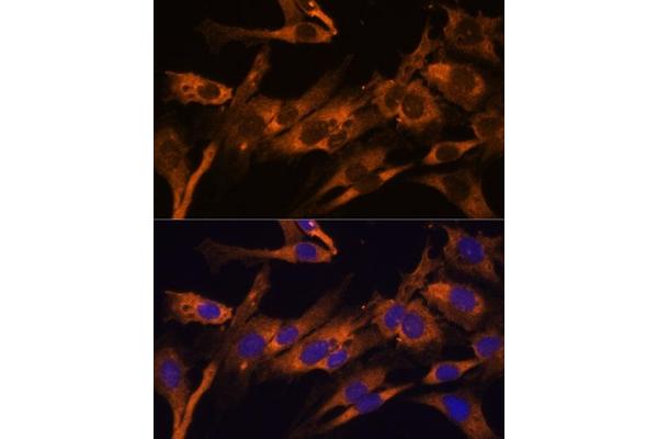 RPL36AL antibody  (AA 1-106)
